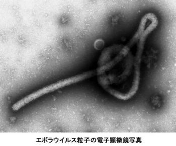 エボラウイルス粒子の電子顕微鏡写真.jpg